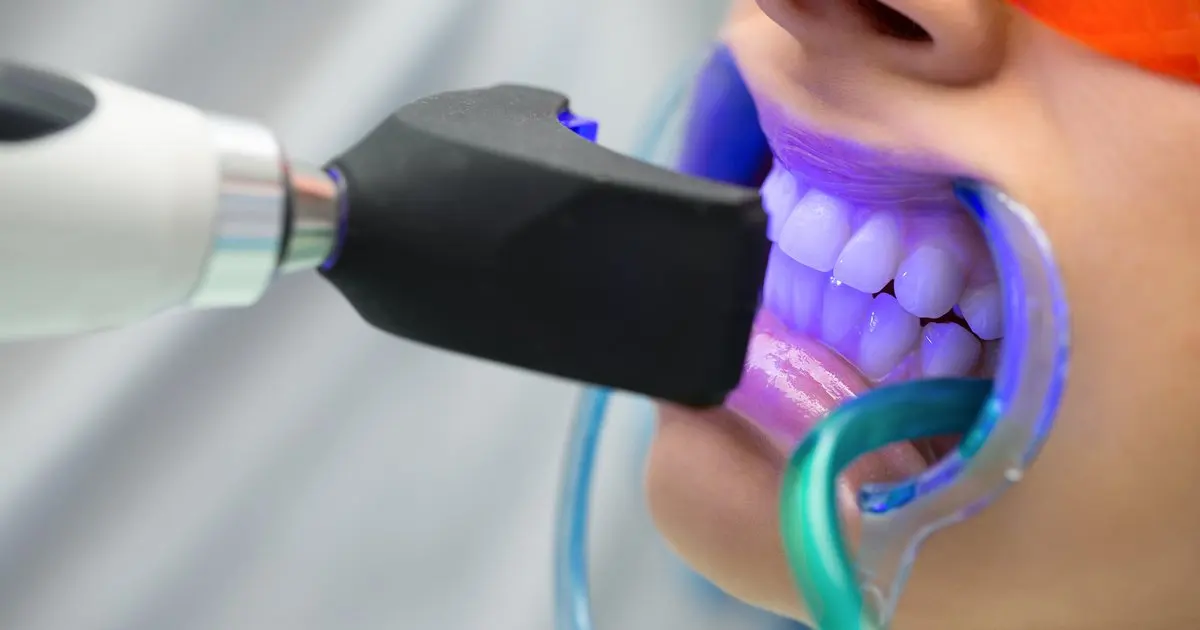 Estética dental en Madrid