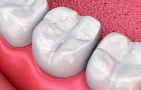Odontología general en Carabanchel - Clínica Dental Dr. Jorge González Cogollo