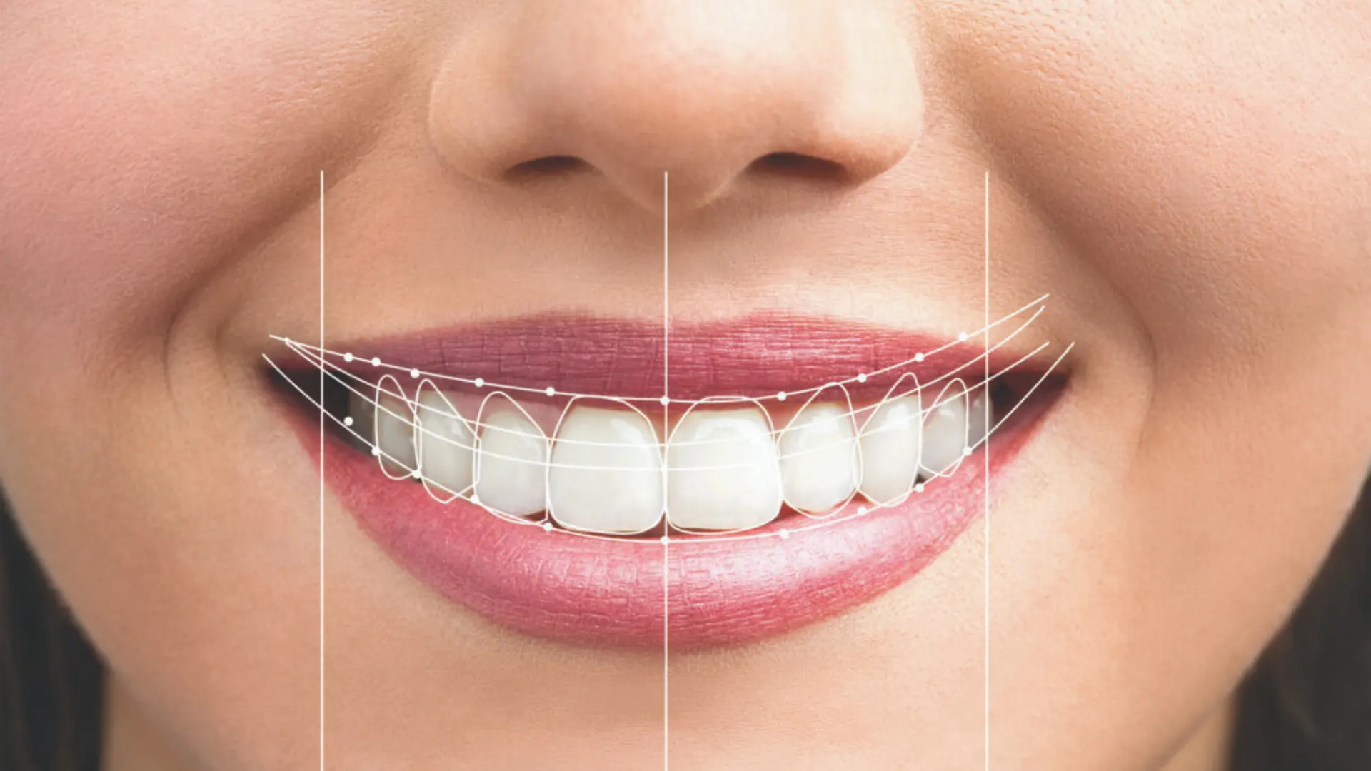 Financiación y facilidades de pago en clínica dental